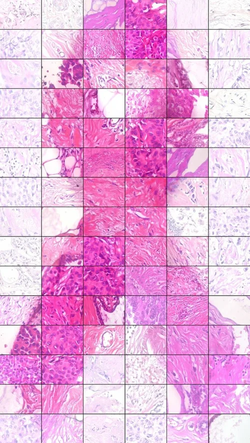 Cancer Outreach