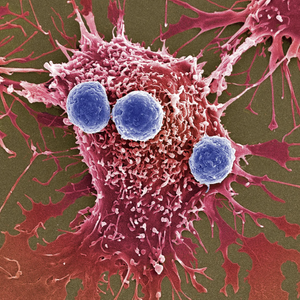 New weapons against cancer: millions of bacteria programmed to kill