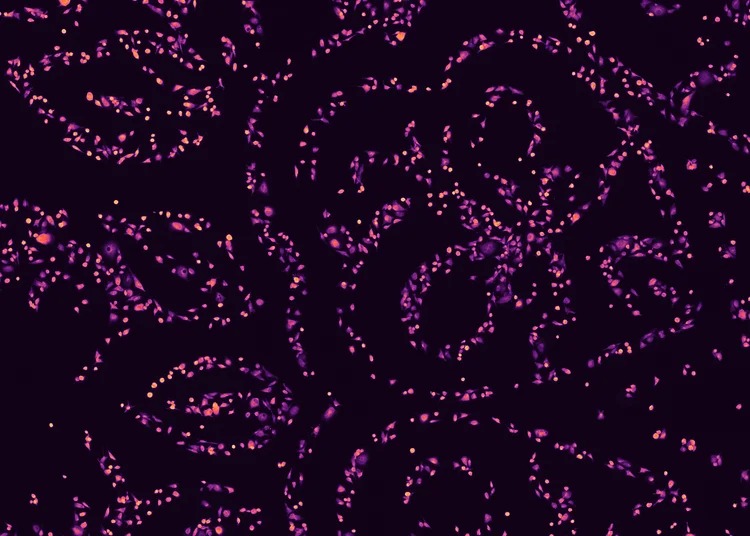 Colonies artwork