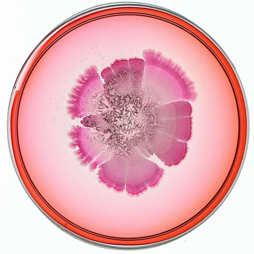 Beautiful Bacteria petri dish artwork with pink radiating pattern