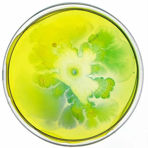 Beautiful Bacteria petri dish artwork in luminous yellow and green
